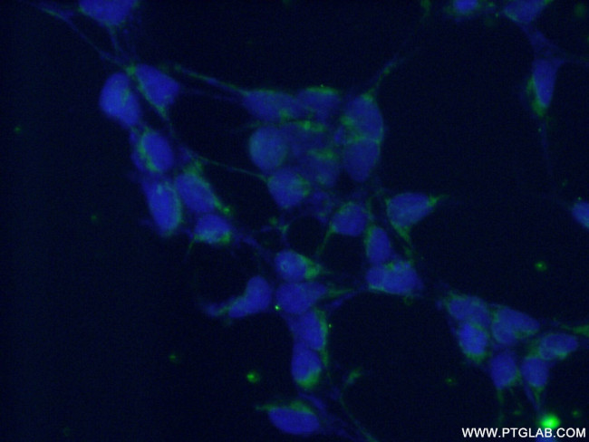 DGKE Antibody in Immunocytochemistry (ICC/IF)