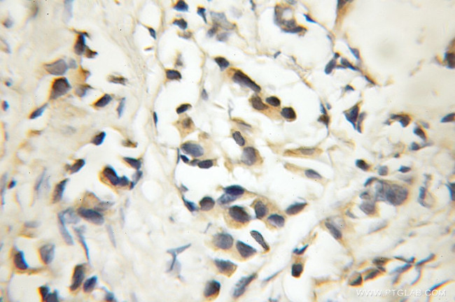 DGKE Antibody in Immunohistochemistry (Paraffin) (IHC (P))