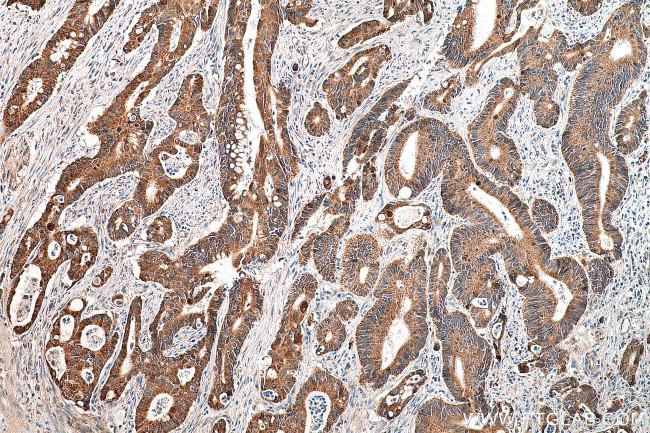 DGKE Antibody in Immunohistochemistry (Paraffin) (IHC (P))