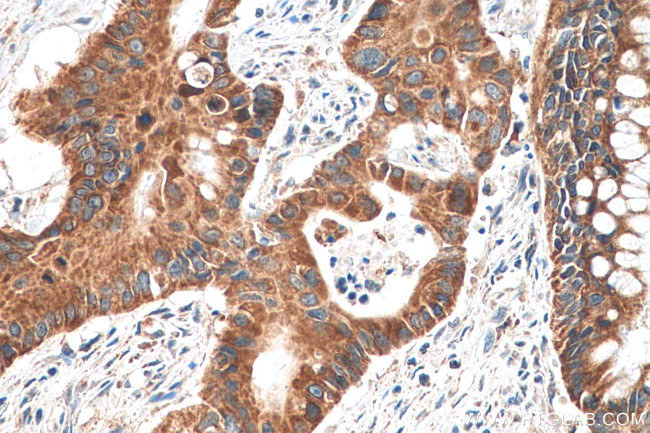 DGKE Antibody in Immunohistochemistry (Paraffin) (IHC (P))