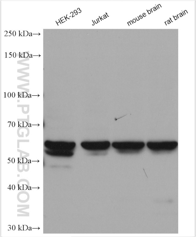 DGKE Antibody in Western Blot (WB)