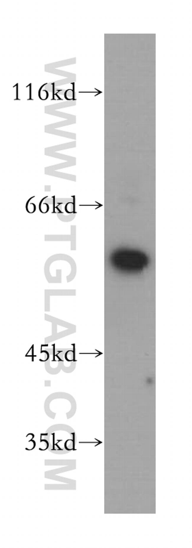 DGKE Antibody in Western Blot (WB)