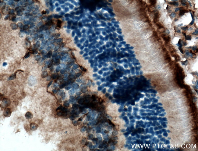 RGR Antibody in Immunohistochemistry (Paraffin) (IHC (P))