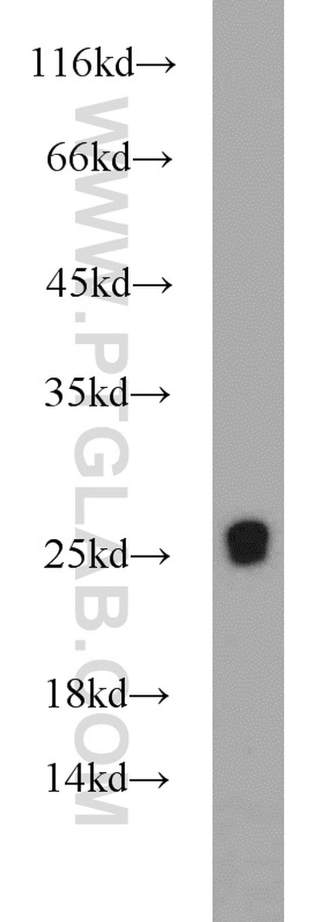 RGR Antibody in Western Blot (WB)