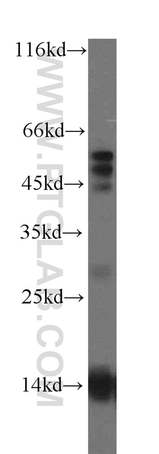 RNF7 Antibody in Western Blot (WB)