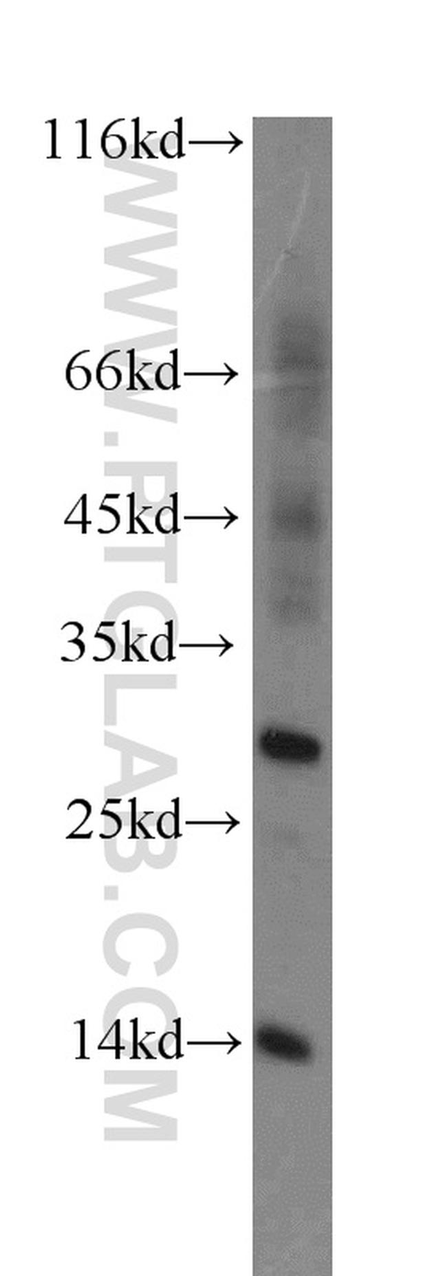 RNF7 Antibody in Western Blot (WB)