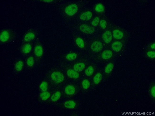 ATF2 Antibody in Immunocytochemistry (ICC/IF)