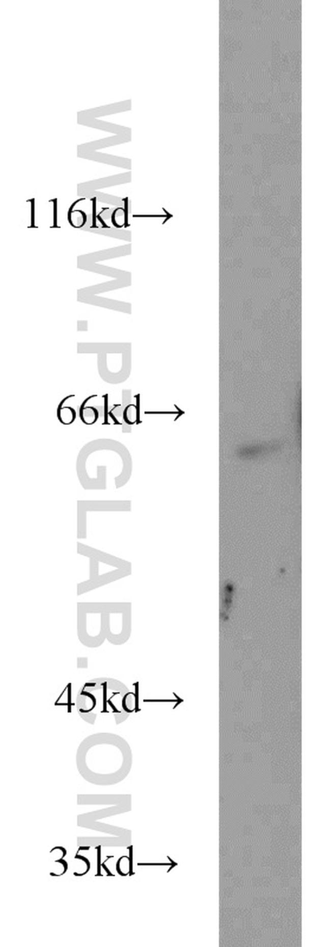 ATF2 Antibody in Western Blot (WB)