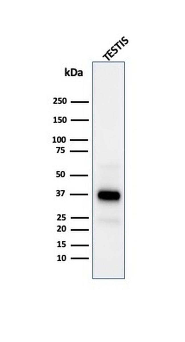 Clusterin/Apolipoprotein J (APO-J) Antibody in Western Blot (WB)