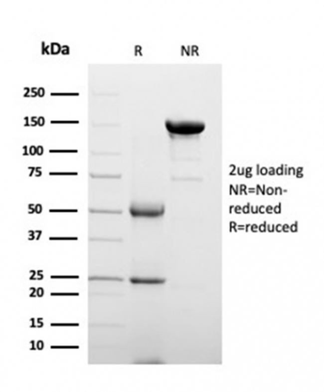 Clusterin/Apolipoprotein J (APO-J) Antibody in Immunoelectrophoresis (IE)