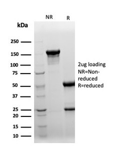 Clusterin/Apolipoprotein J (APO-J) Antibody in SDS-PAGE (SDS-PAGE)