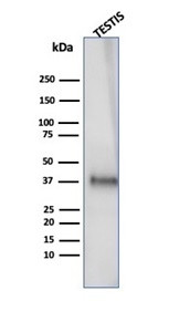 Clusterin/Apolipoprotein J (APO-J) Antibody in Western Blot (WB)