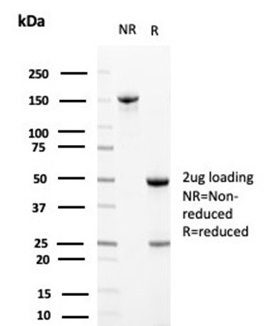 Clusterin/Apolipoprotein J (APO-J) Antibody in SDS-PAGE (SDS-PAGE)