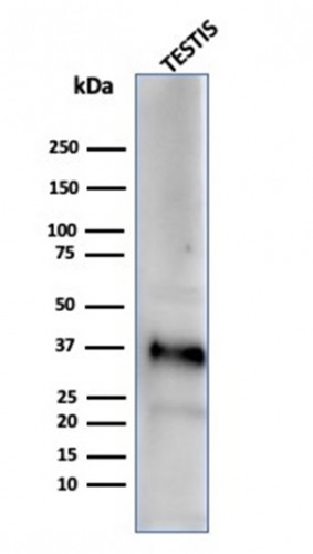 Clusterin/Apolipoprotein J (APO-J) Antibody in Western Blot (WB)
