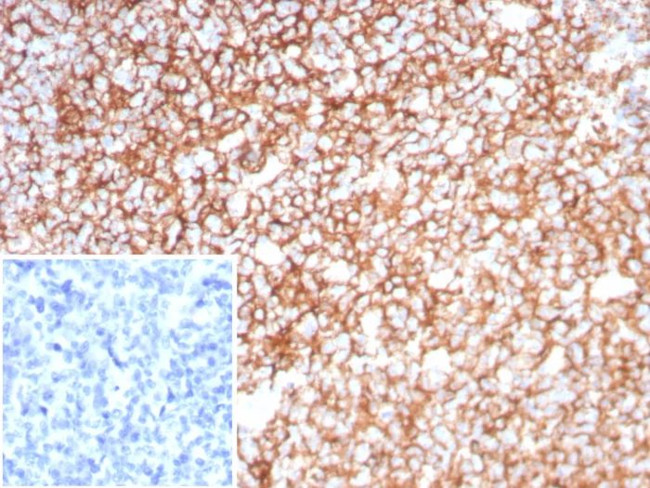 Clusterin/Apolipoprotein J (APO-J) Antibody in Immunohistochemistry (Paraffin) (IHC (P))