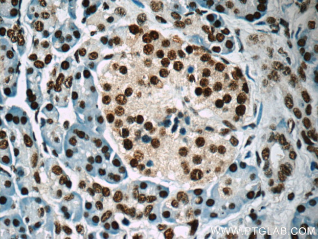 HuR Antibody in Immunohistochemistry (Paraffin) (IHC (P))