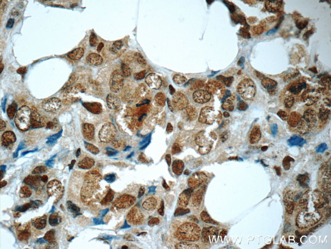 HuR Antibody in Immunohistochemistry (Paraffin) (IHC (P))