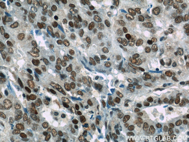 HuR Antibody in Immunohistochemistry (Paraffin) (IHC (P))