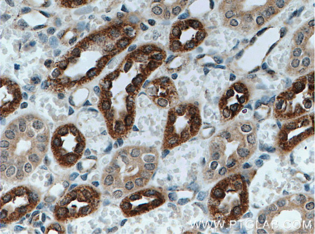 Uromodulin Antibody in Immunohistochemistry (Paraffin) (IHC (P))