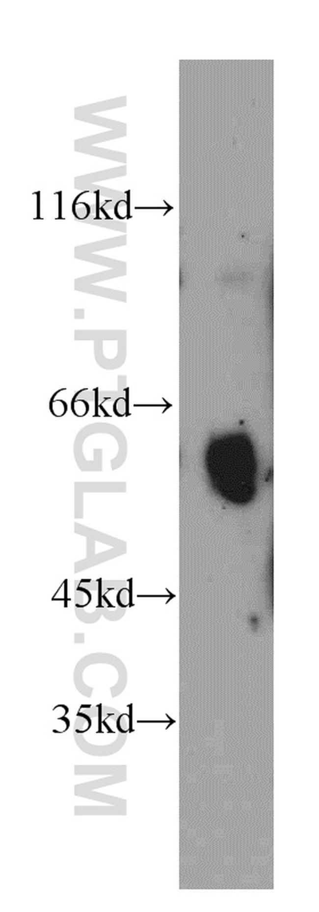 Uromodulin Antibody in Western Blot (WB)