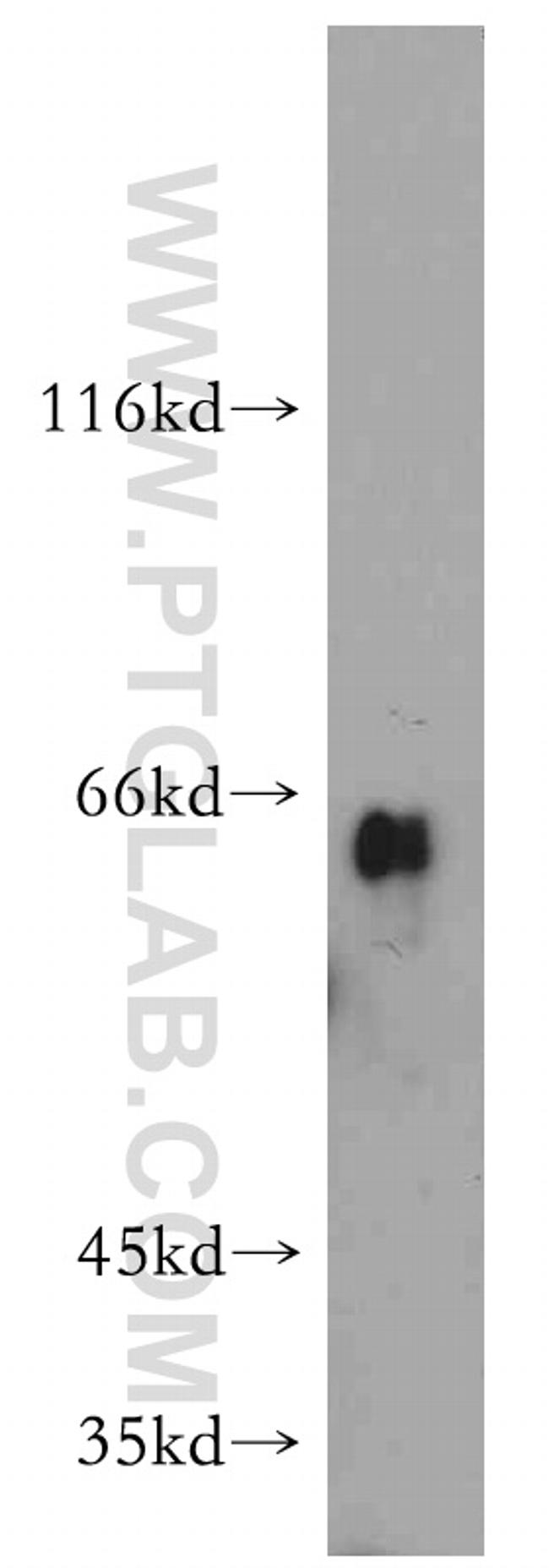 Uromodulin Antibody in Western Blot (WB)