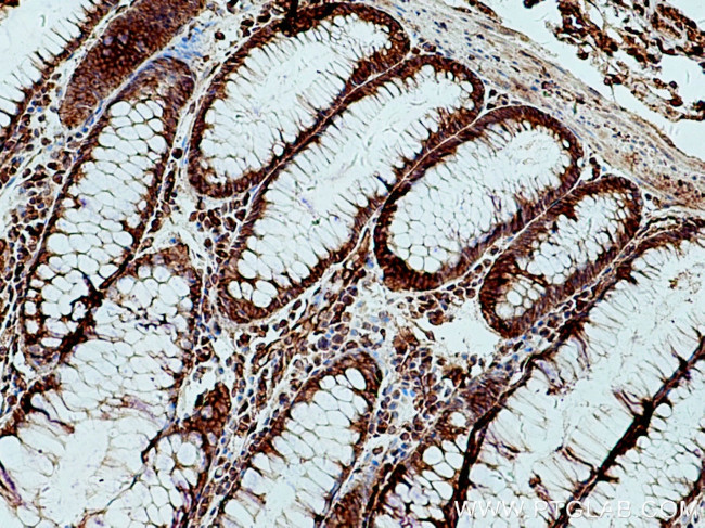 Sec8 Antibody in Immunohistochemistry (Paraffin) (IHC (P))