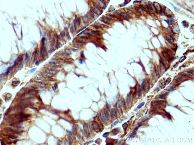 Sec8 Antibody in Immunohistochemistry (Paraffin) (IHC (P))