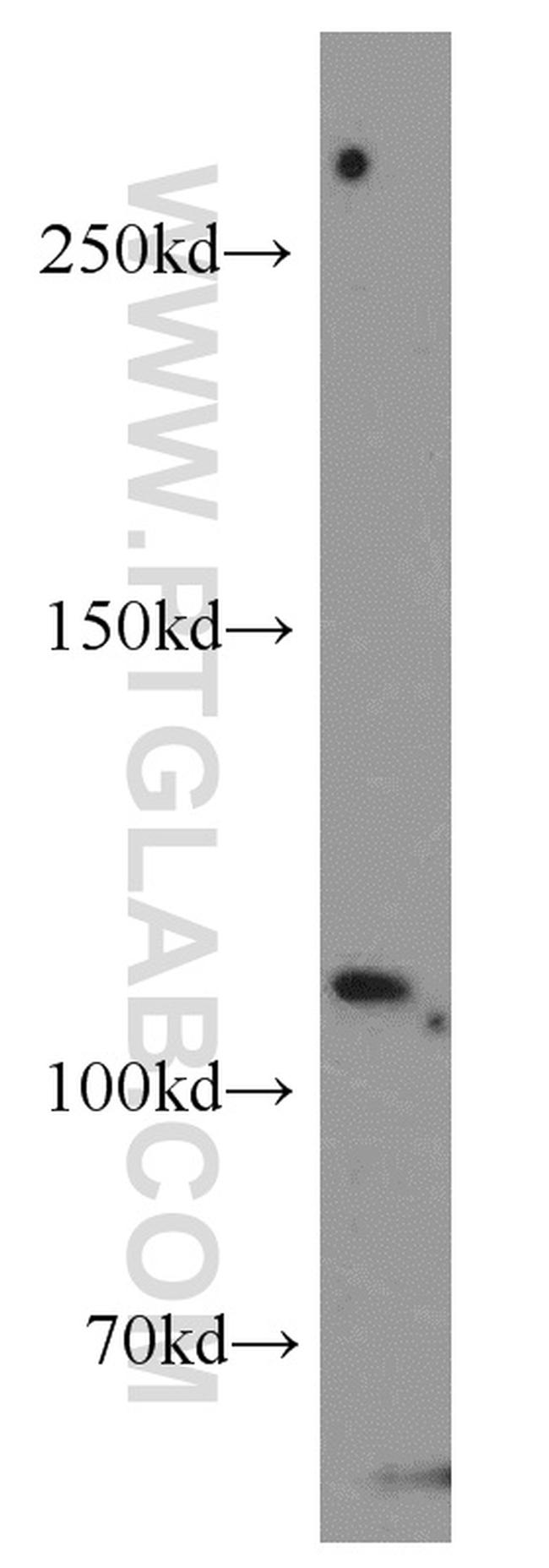 Sec8 Antibody in Western Blot (WB)