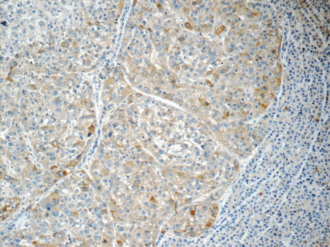 RABL3 Antibody in Immunohistochemistry (Paraffin) (IHC (P))