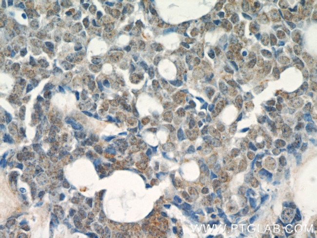 RABL3 Antibody in Immunohistochemistry (Paraffin) (IHC (P))