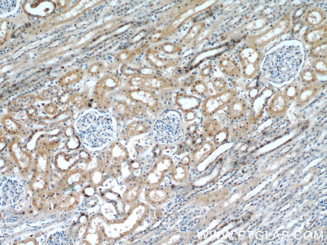 RABL3 Antibody in Immunohistochemistry (Paraffin) (IHC (P))