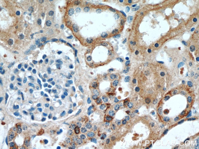 RABL3 Antibody in Immunohistochemistry (Paraffin) (IHC (P))