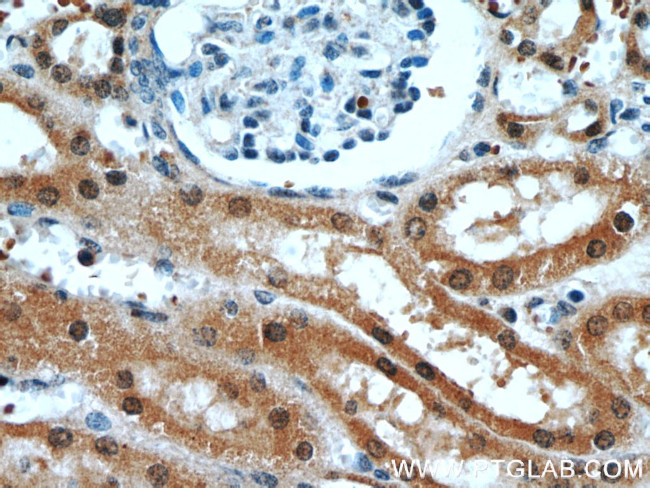 RABL3 Antibody in Immunohistochemistry (Paraffin) (IHC (P))