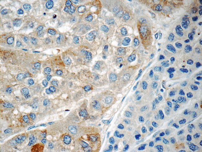 RABL3 Antibody in Immunohistochemistry (Paraffin) (IHC (P))