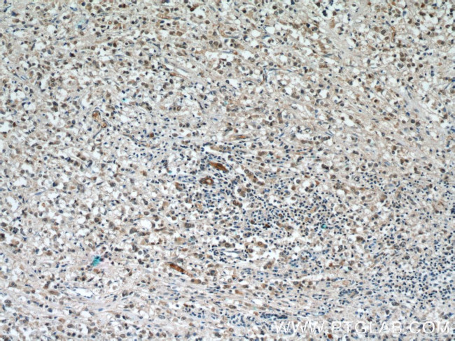 RABL3 Antibody in Immunohistochemistry (Paraffin) (IHC (P))