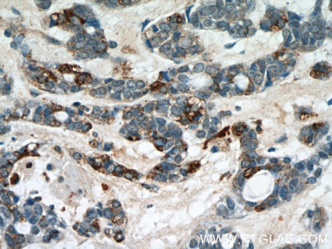 RABL3 Antibody in Immunohistochemistry (Paraffin) (IHC (P))