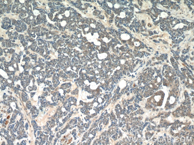 RABL3 Antibody in Immunohistochemistry (Paraffin) (IHC (P))