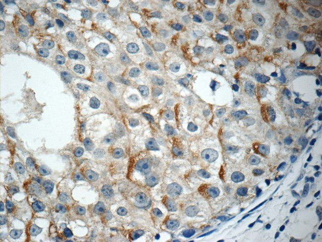 RABL3 Antibody in Immunohistochemistry (Paraffin) (IHC (P))