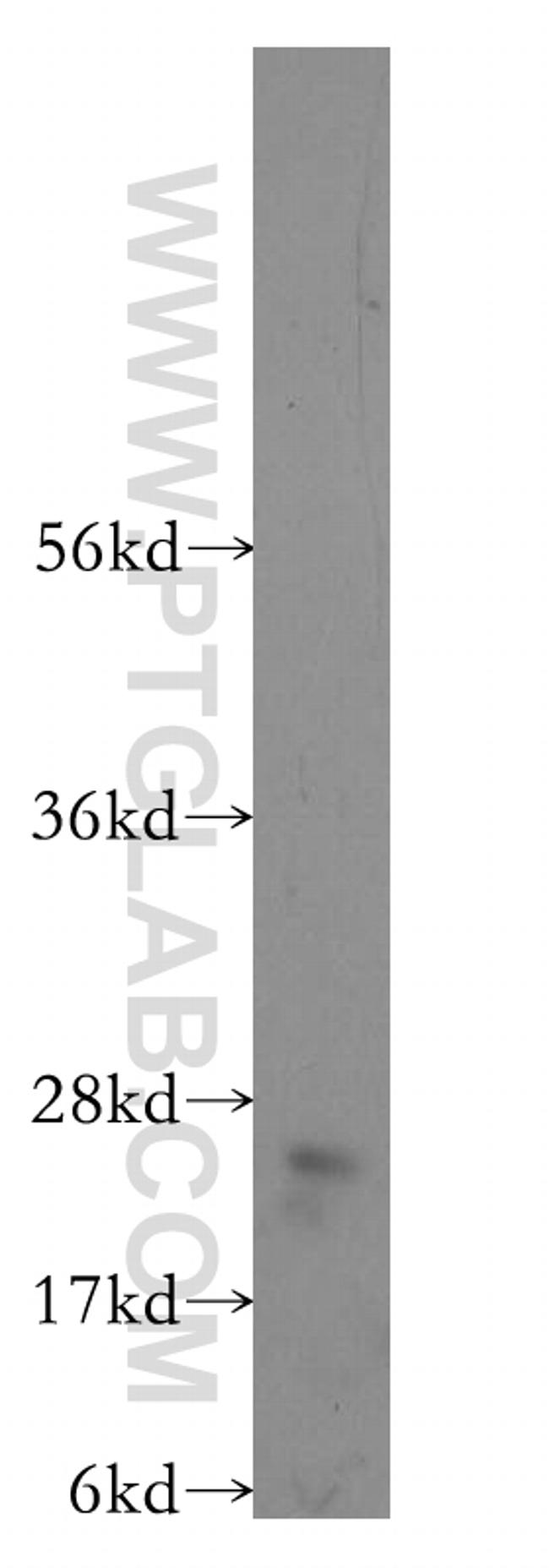 RABL3 Antibody in Western Blot (WB)