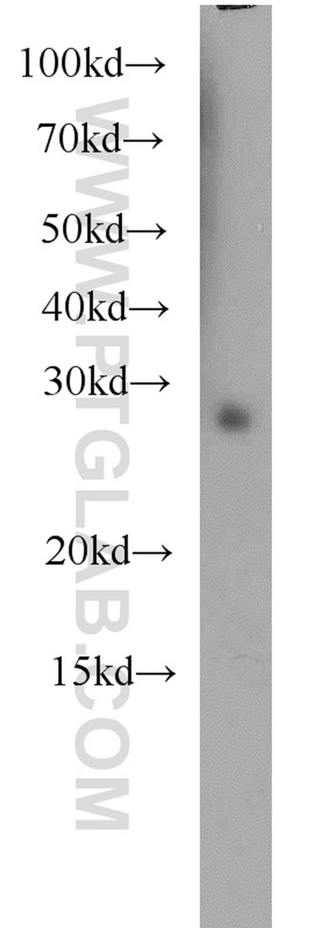 RABL3 Antibody in Western Blot (WB)