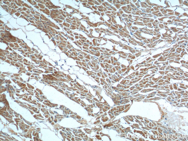 ST2 Antibody in Immunohistochemistry (Paraffin) (IHC (P))