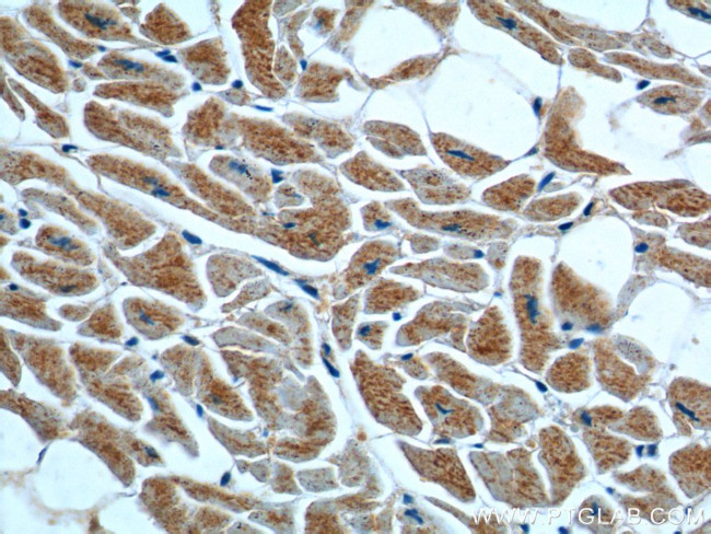 ST2 Antibody in Immunohistochemistry (Paraffin) (IHC (P))