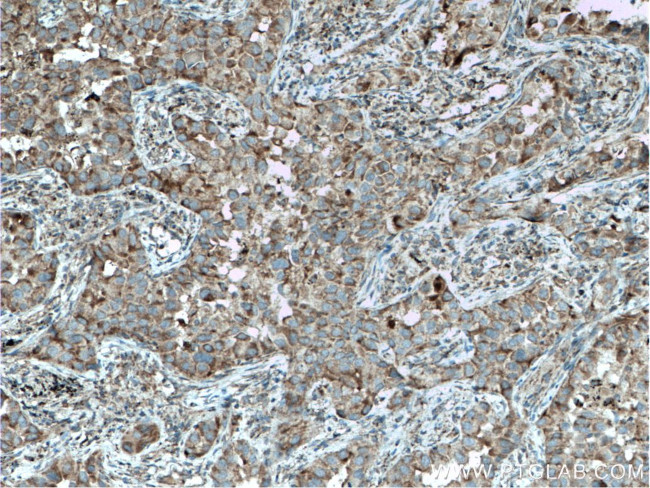 ST2 Antibody in Immunohistochemistry (Paraffin) (IHC (P))