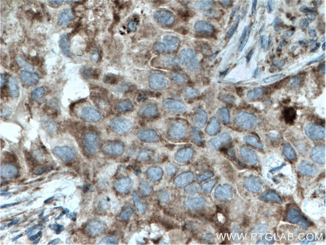 ST2 Antibody in Immunohistochemistry (Paraffin) (IHC (P))