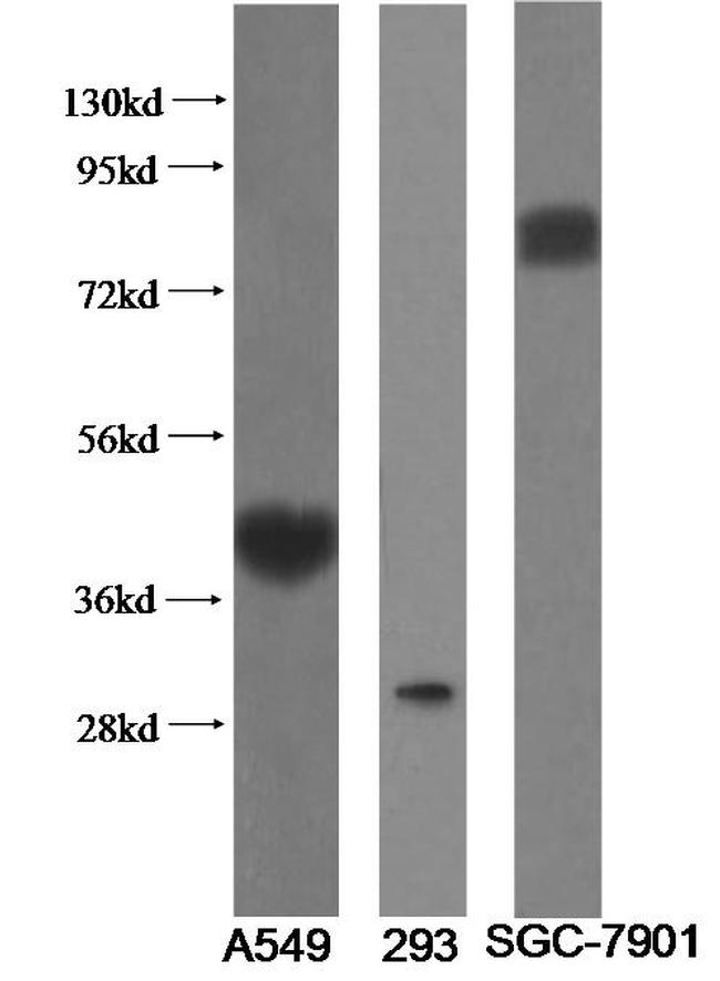 ST2 Antibody in Western Blot (WB)