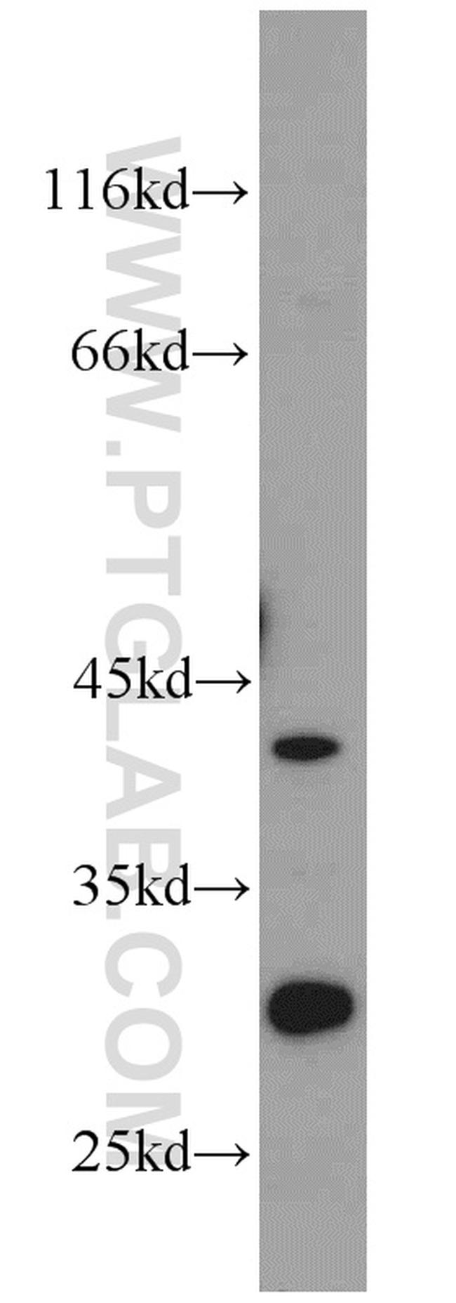 ST2 Antibody in Western Blot (WB)