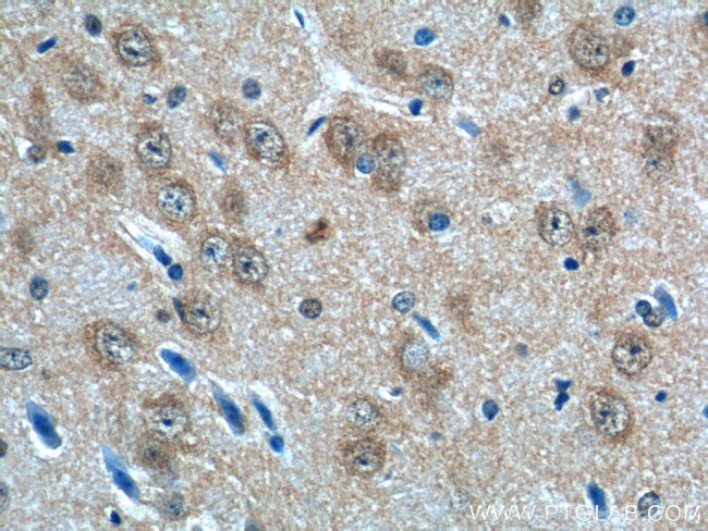 AP3M2 Antibody in Immunohistochemistry (Paraffin) (IHC (P))