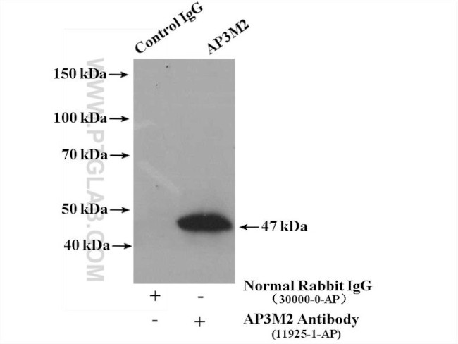 AP3M2 Antibody in Immunoprecipitation (IP)