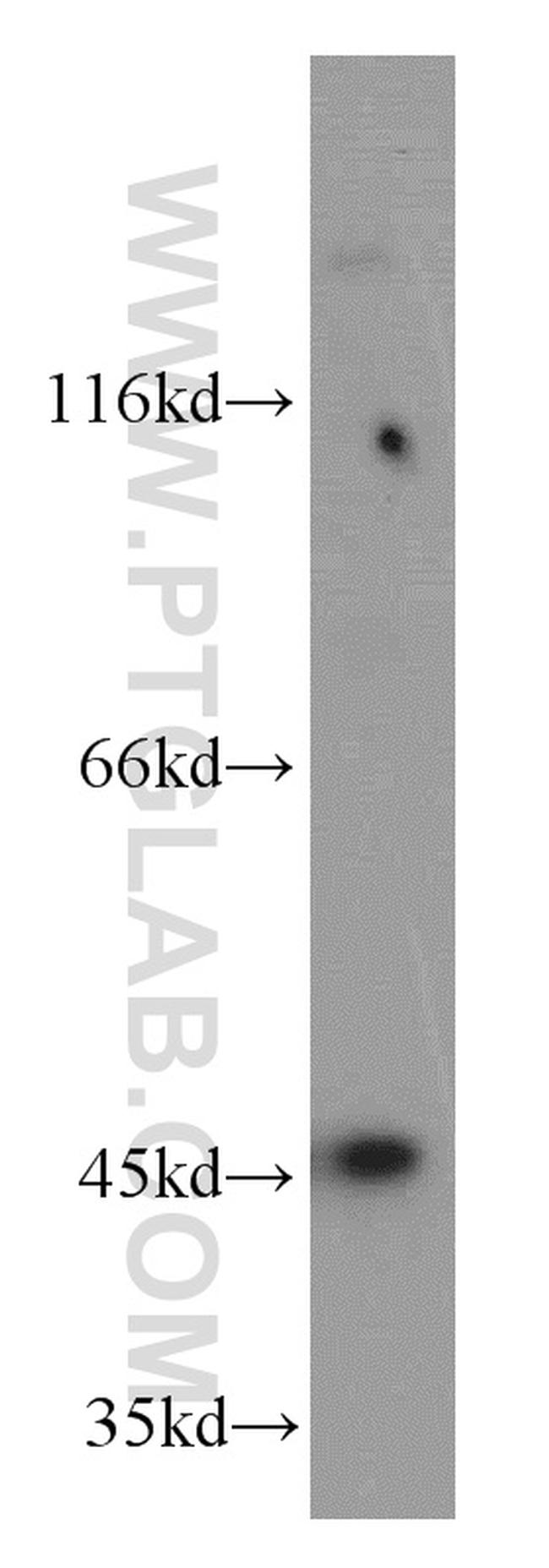 AP3M2 Antibody in Western Blot (WB)