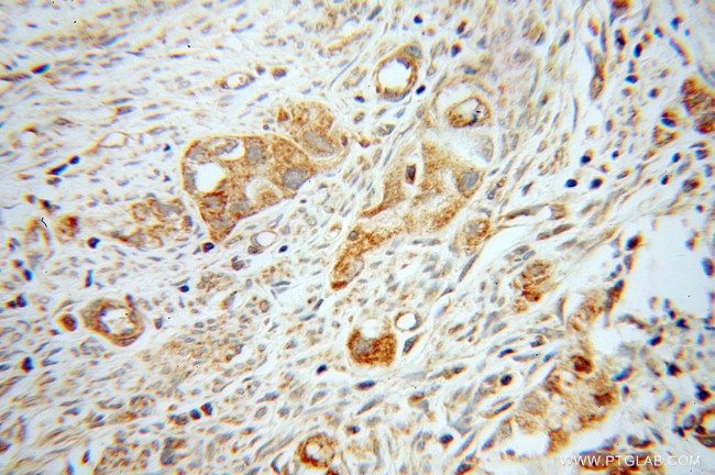 Kininogen 1 Antibody in Immunohistochemistry (Paraffin) (IHC (P))